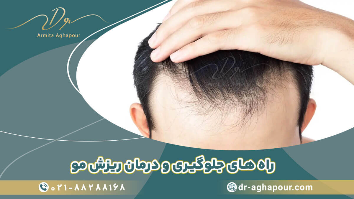 راه های درمان ریزش مو